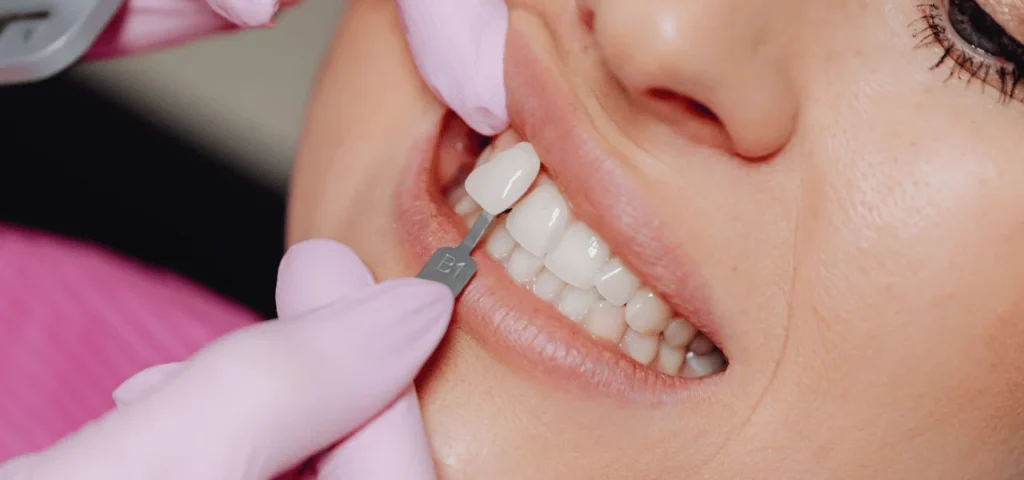 Benefits of dental implants in Huddersfield for replacing missing teeth