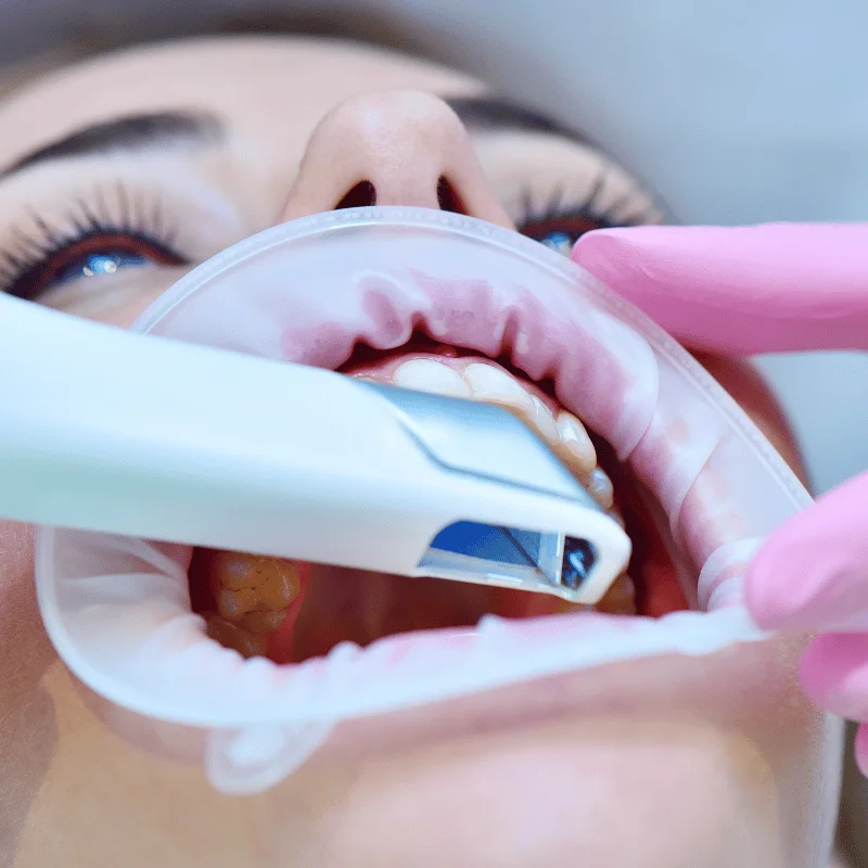 Dental implants in Huddersfield for replacing missing teeth