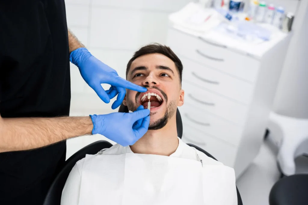 Teeth whitening in Huddersfield for patients with stained or discoloured teeth